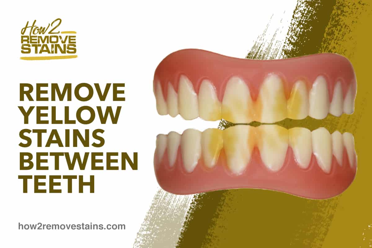 Comment éliminer les taches jaunes entre les dents