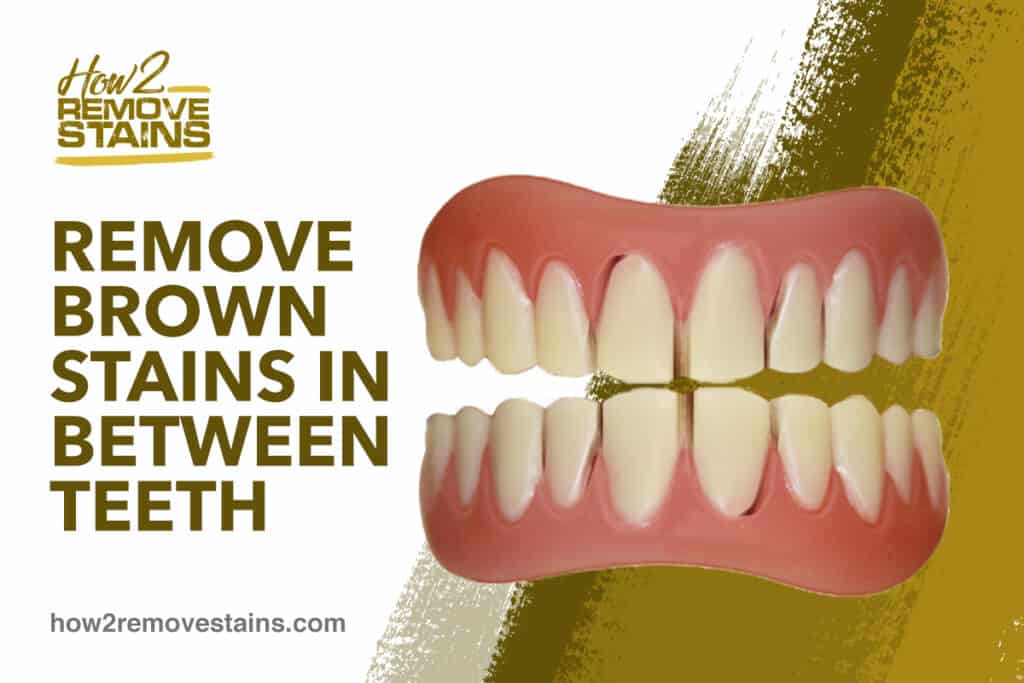 Comment éliminer les taches brunes entre les dents [ Réponse détaillée ]